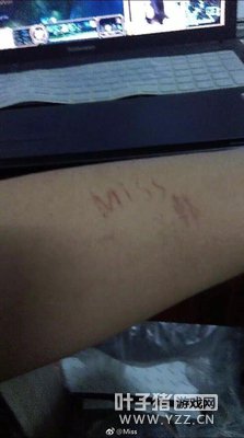 ��˿Ҫ��Miss�����ϣ���С��������Ӧ��